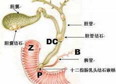 癫痫病症状得了癫痫病究竟该如何选择用药
